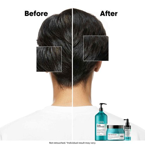 L'Oreal Professionnel Anti-Oiliness Shampoo 1500ml - Festive Scheme | L'Or&eacute;al Partner Shop