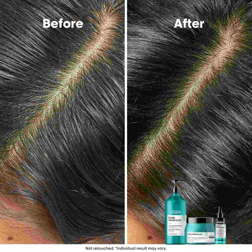 L'Oreal Professionnel Anti-Oiliness Shampoo 1500ml - Festive Scheme | L'Or&eacute;al Partner Shop