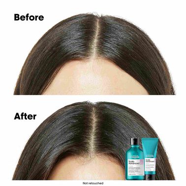 L'Oréal Professionnel Scalp Advanced 5-in-1 Professional Leave-in Serum 90ml - Scalp Advanced L'Oréal Professionnel Scalp Advanced 5-in-1 Professional Leave-in Serum 90ml - Scalp Advanced | L'Oréal Partner Shop