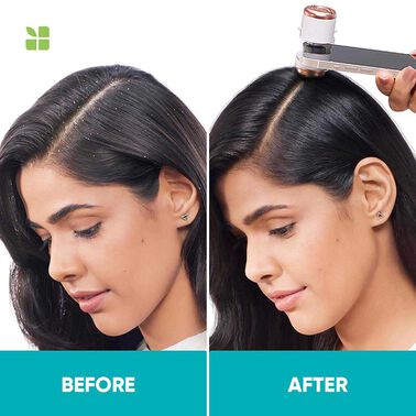 Biolage Scalppure Conditioner - Biolage | L'Oréal Partner Shop