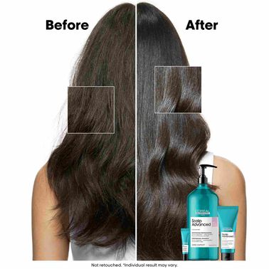 L'Oreal Professionnel Anti-Discomfort Shampoo 1500ml - Scalp Advanced | L'Oréal Partner Shop