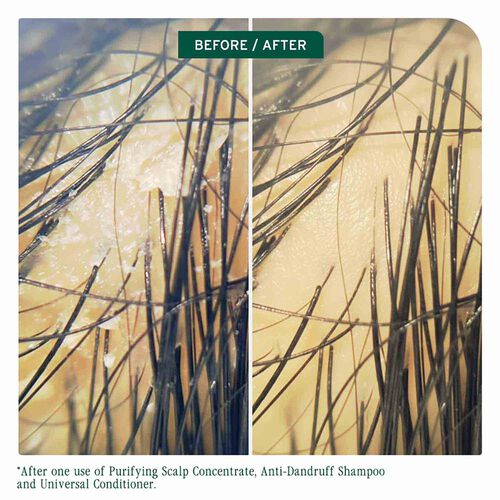 Biolage Scalp Sync Purifying Concentrate - Biolage Concentrate | L'Or&eacute;al Partner Shop