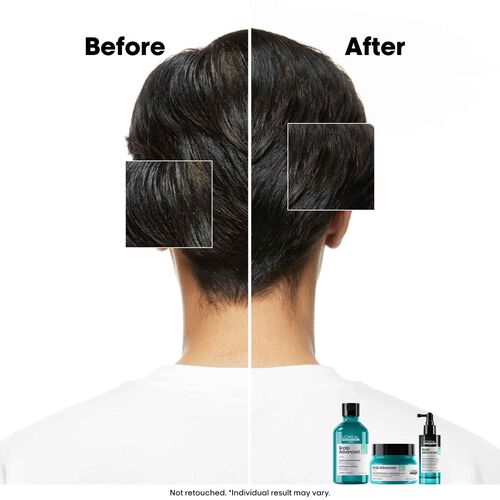 L'Oreal Professionnel Anti-Oiliness 2-in-1 Deep Purifier Clay 250ml - L'Or&eacute;al Professionnel Haircare | L'Or&eacute;al Partner Shop