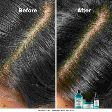 L'Oreal Professionnel Anti-Oiliness 2-in-1 Deep Purifier Clay 250ml - L'Oréal Professionnel Haircare L'Oreal Professionnel Anti-Oiliness 2-in-1 Deep Purifier Clay 250ml - L'Oréal Professionnel Haircare | L'Oréal Partner Shop