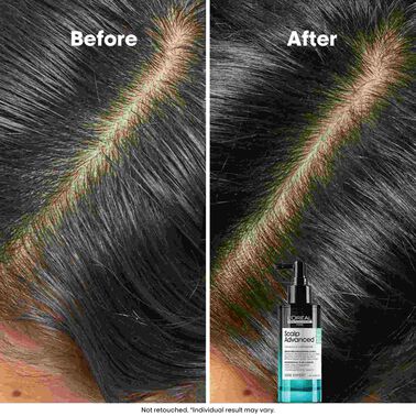 L'Oréal Professionnel Scalp Advanced 5-in-1 Professional Leave-in Serum 90ml - Scalp Advanced L'Oréal Professionnel Scalp Advanced 5-in-1 Professional Leave-in Serum 90ml - Scalp Advanced | L'Oréal Partner Shop