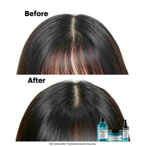 L'Oreal Professionnel Anti-Oiliness Shampoo 300ml - Festive Scheme | L'Or&eacute;al Partner Shop