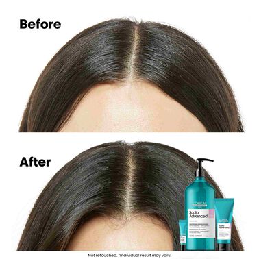 L'Oreal Professionnel Anti-Discomfort Shampoo 1500ml - Scalp Advanced | L'Oréal Partner Shop