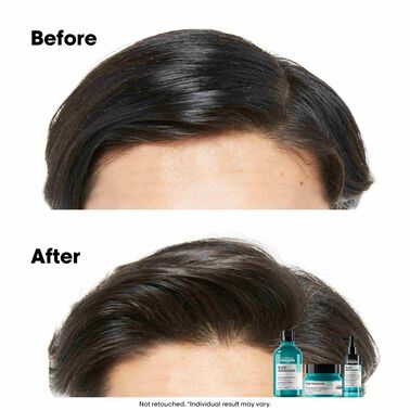 L'Oreal Professionnel Anti-Oiliness Shampoo 300ml - Scalp Advanced | L'Oréal Partner Shop