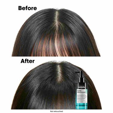 L'Oréal Professionnel Scalp Advanced 5-in-1 Professional Leave-in Serum 90ml - Scalp Advanced L'Oréal Professionnel Scalp Advanced 5-in-1 Professional Leave-in Serum 90ml - Scalp Advanced | L'Oréal Partner Shop