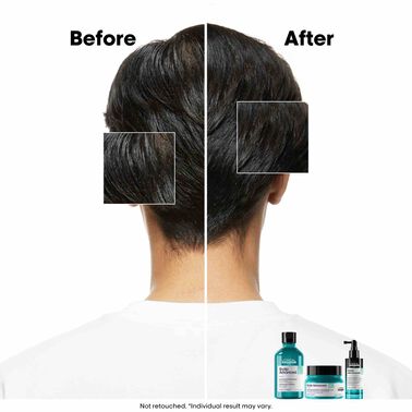 L'Oreal Professionnel Anti-Oiliness Shampoo 300ml - Scalp Advanced | L'Oréal Partner Shop