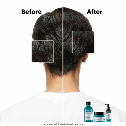 L'Oreal Professionnel Anti-Oiliness Shampoo 300ml - Festive Scheme | L'Or&eacute;al Partner Shop